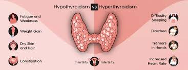 Ayurvedic to Cure Thyroid & Hypothyroid image