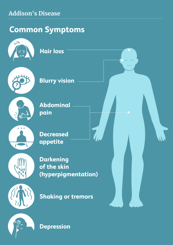 Addison's-disease-symptoms